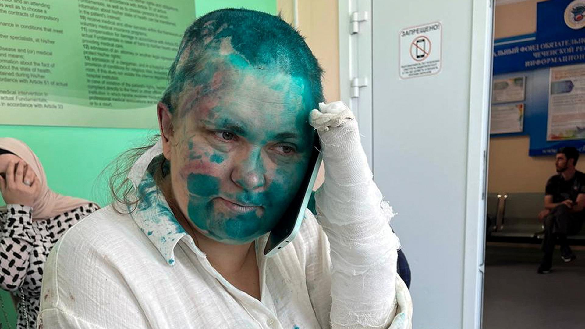 Milashina sitzt mit ernstem Blick auf einer Couch in einem Raum und telefoniert. Deine Hände sind verbunden. Ihr Gesicht und ihr weißes Hemd sind mit grüner Farbe beschmiert. Hinter ihr sitzt eine Frau mit Kopftuch und bedeckt ihr Gesicht mit der Hand. Milashina sitzt mit ernstem Blick auf einer Couch in einem Raum und telefoniert. Deine Hände sind verbunden. Ihr Gesicht und ihr weißes Hemd sind mit grüner Farbe beschmiert. Hinter ihr sitzt eine Frau mit Kopftuch und bedeckt ihr Gesicht mit der Hand.