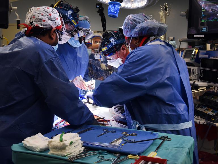 Ärzte während der ersten Transplantation eines Schweineherzens in einen Menschen

