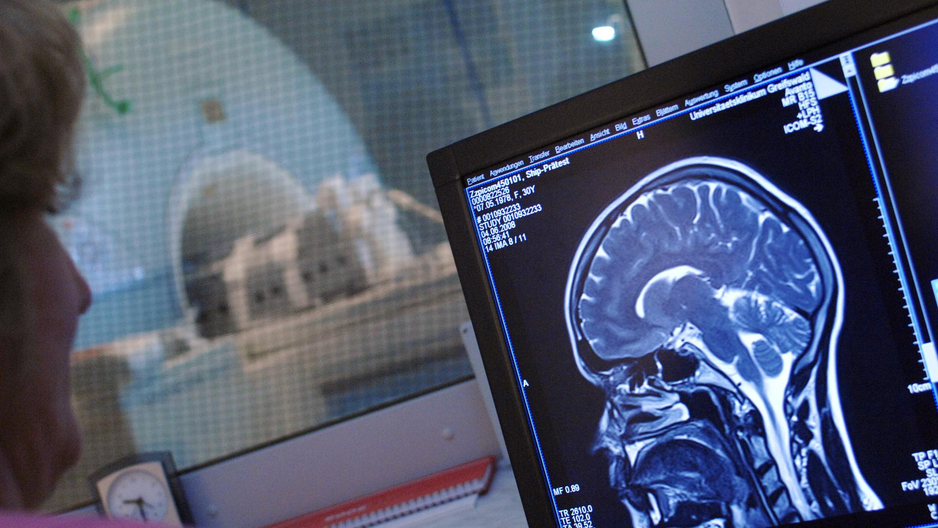 Eine Medizinisch Technische Radiologie-Assistentin kontrolliert Aufnahmen, die mit einem Magnetresonanztomographen erstellt werden (Archivbild) Eine Medizinisch Technische Radiologie-Assistentin kontrolliert Aufnahmen, die mit einem Magnetresonanztomographen erstellt werden (Archivbild)