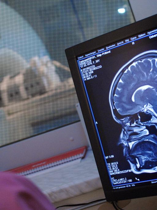 Eine Medizinisch Technische Radiologie-Assistentin kontrolliert Aufnahmen, die mit einem Magnetresonanztomographen erstellt werden (Archivbild)