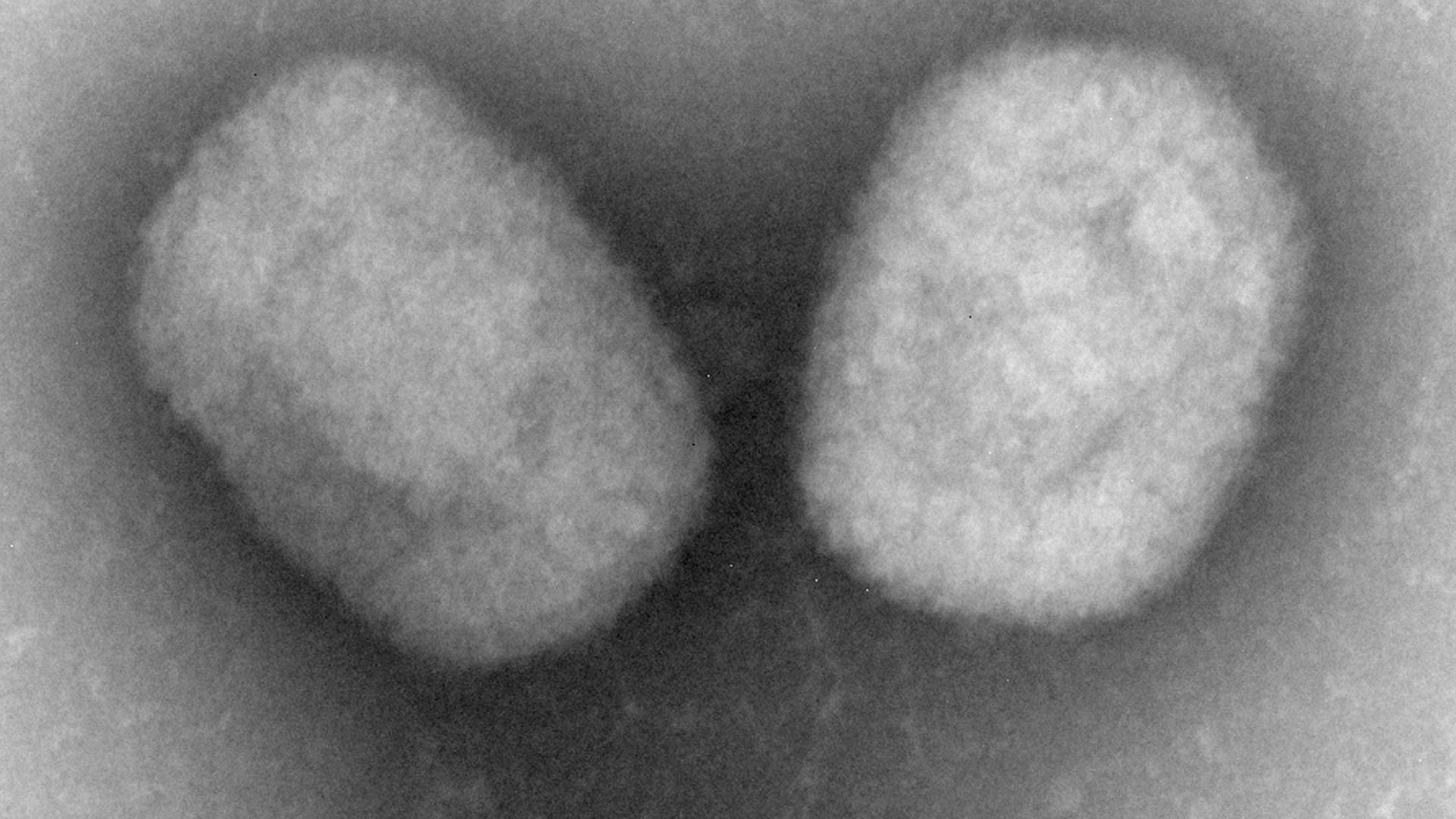 Das Bild zeigt eine Mikroskopaufnahmen von Affenpocken