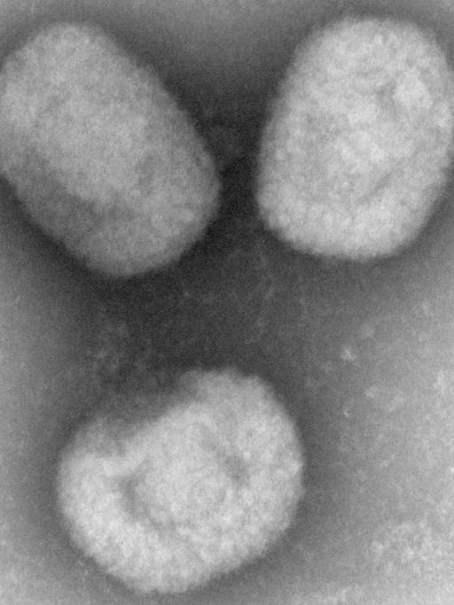 Das Bild zeigt eine Mikroskopaufnahmen von Affenpocken