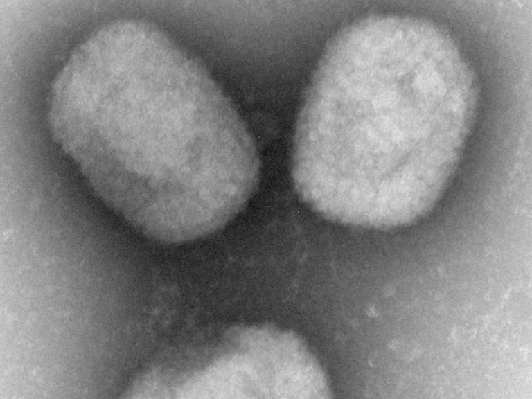 Mikroskopaufnahmen vom New Pox Virus