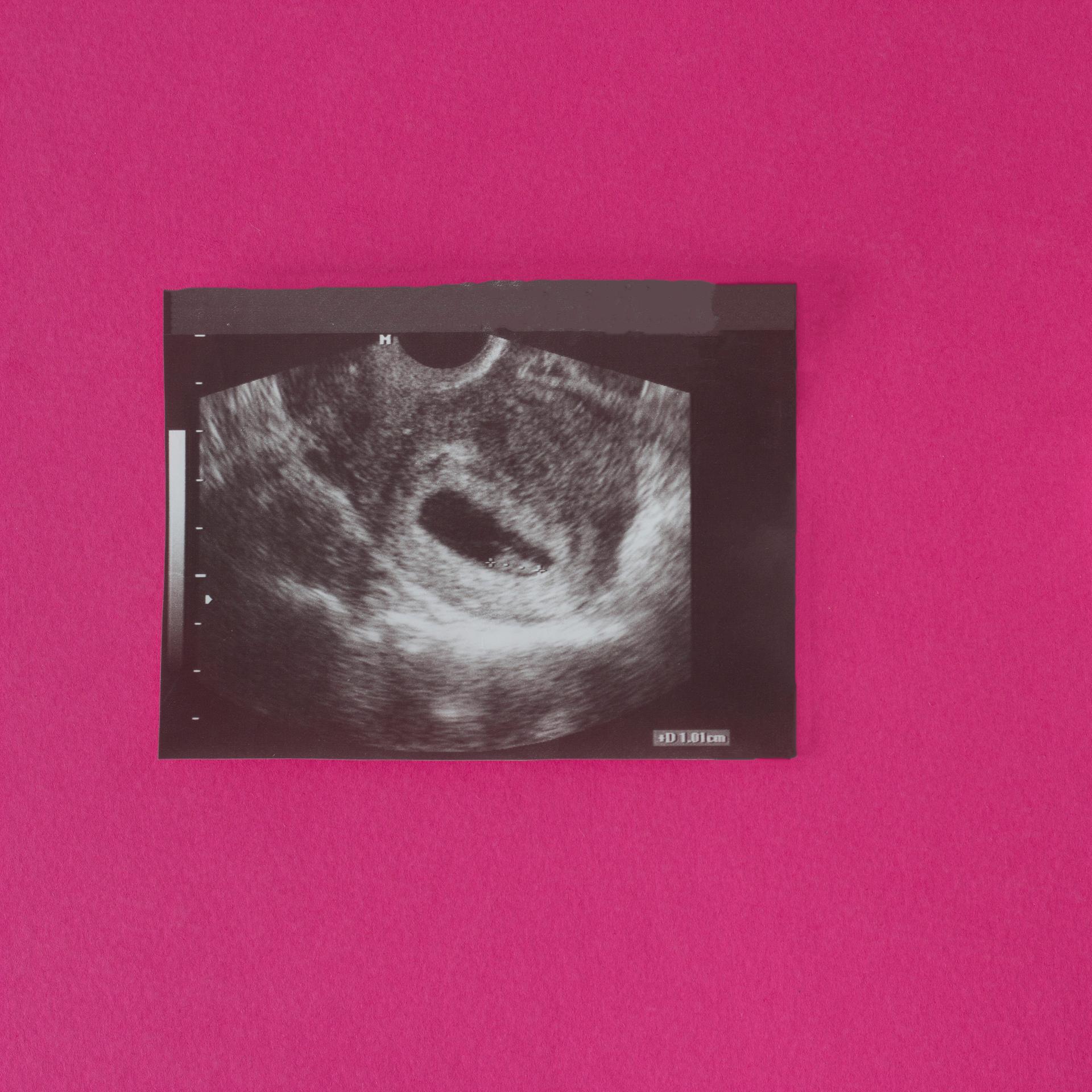 Jeanne Diesteldorf: „(K)eine Mutter“ – Abtreibung – Frauen erzählen ihre Geschichte