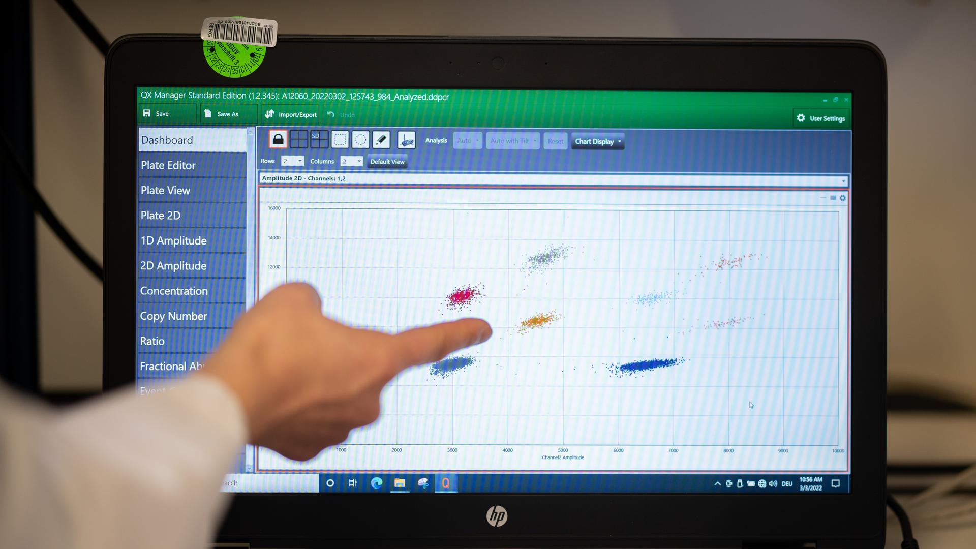 Eine Probenauswertung einer Abwasserprobe mit Nachweisen auf Virusgene des SARS-CoV-2 Virus sind im Institut für Hygiene und Gesundheit in einem Labor auf einem Monitor zu sehen. Eine Probenauswertung einer Abwasserprobe mit Nachweisen auf Virusgene des SARS-CoV-2 Virus sind im Institut für Hygiene und Gesundheit in einem Labor auf einem Monitor zu sehen.