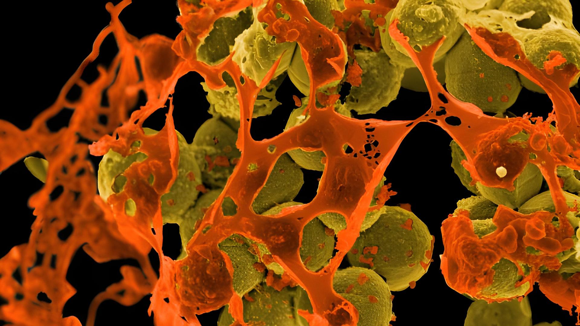 Eine Mikroaufnahme des multiresistenten Bakterium Staphylococcus aureus (MRSA).