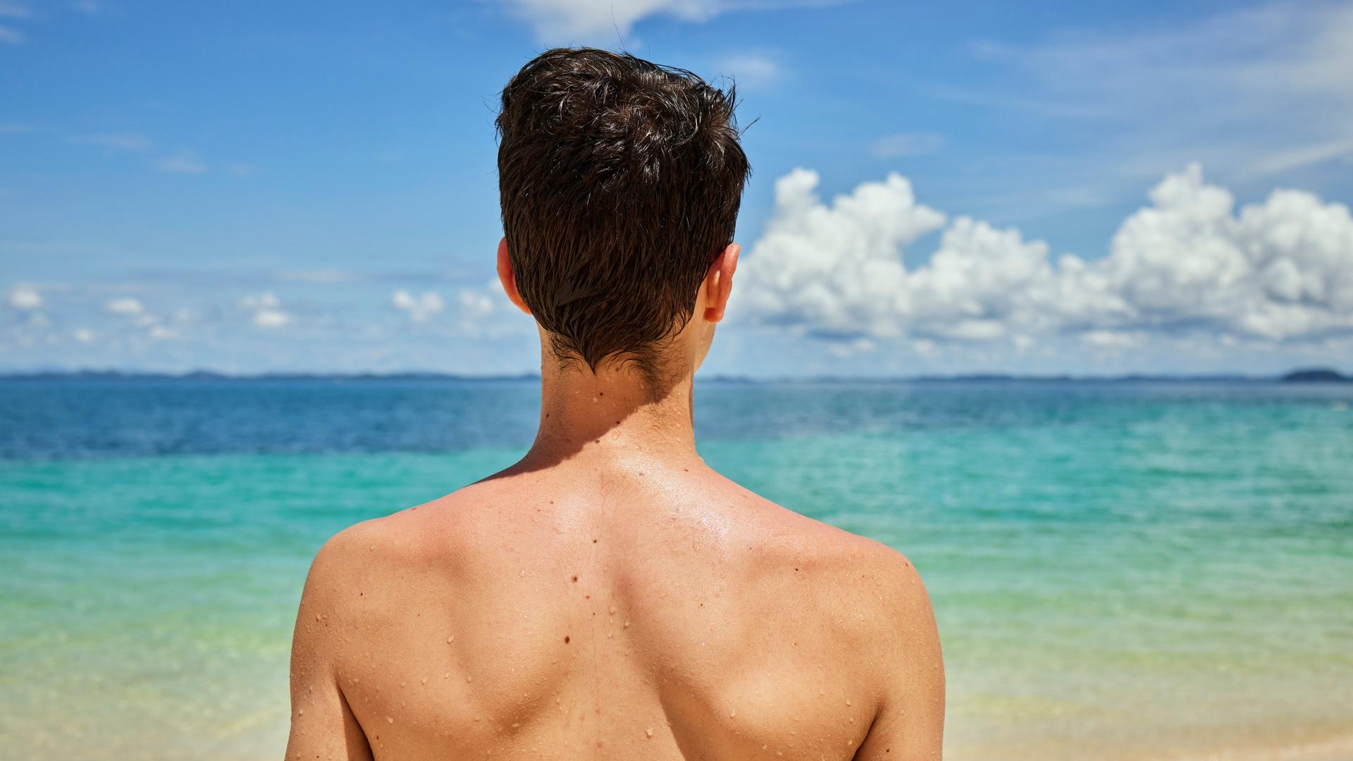 Hautkrebsrate steigt, Dermatologe gibt Tipps zum Sonnenschutz