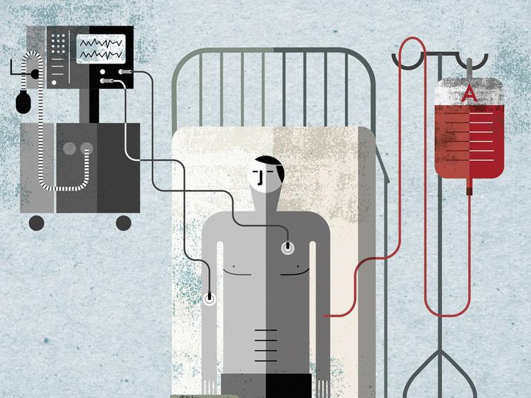 Illustration: Draufsicht eines Patienten im Krankenhausbett, angeschlossen an Tropf und Überwachungsmonitor. 