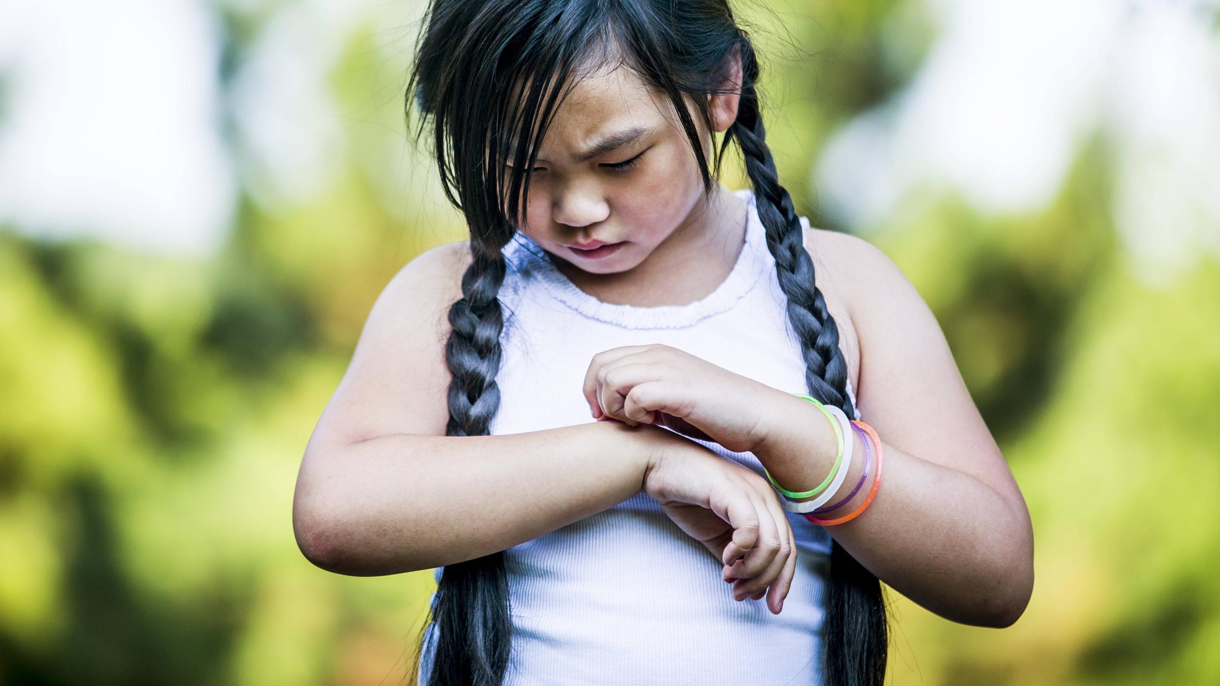 Ein Kind mit langen dunklen Zöpfen kratzt sich an der Hand.
