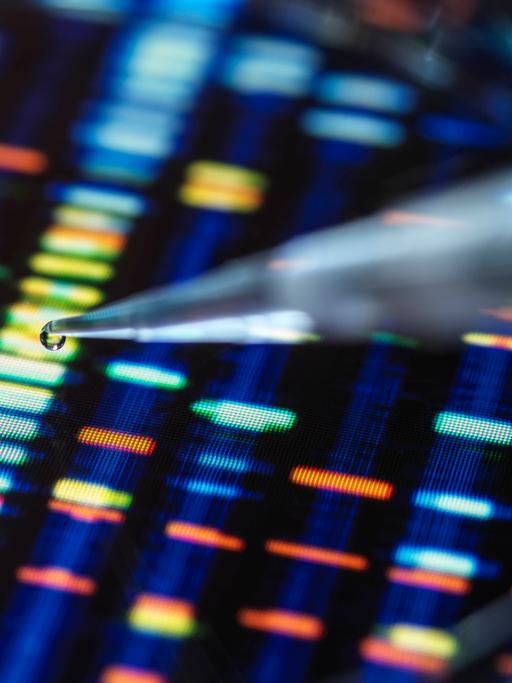 Die Probenentnahme mittels einer Pipette vor dem Hintergrund einer DNA-Code-Darstellung auf einem Bildschirm.