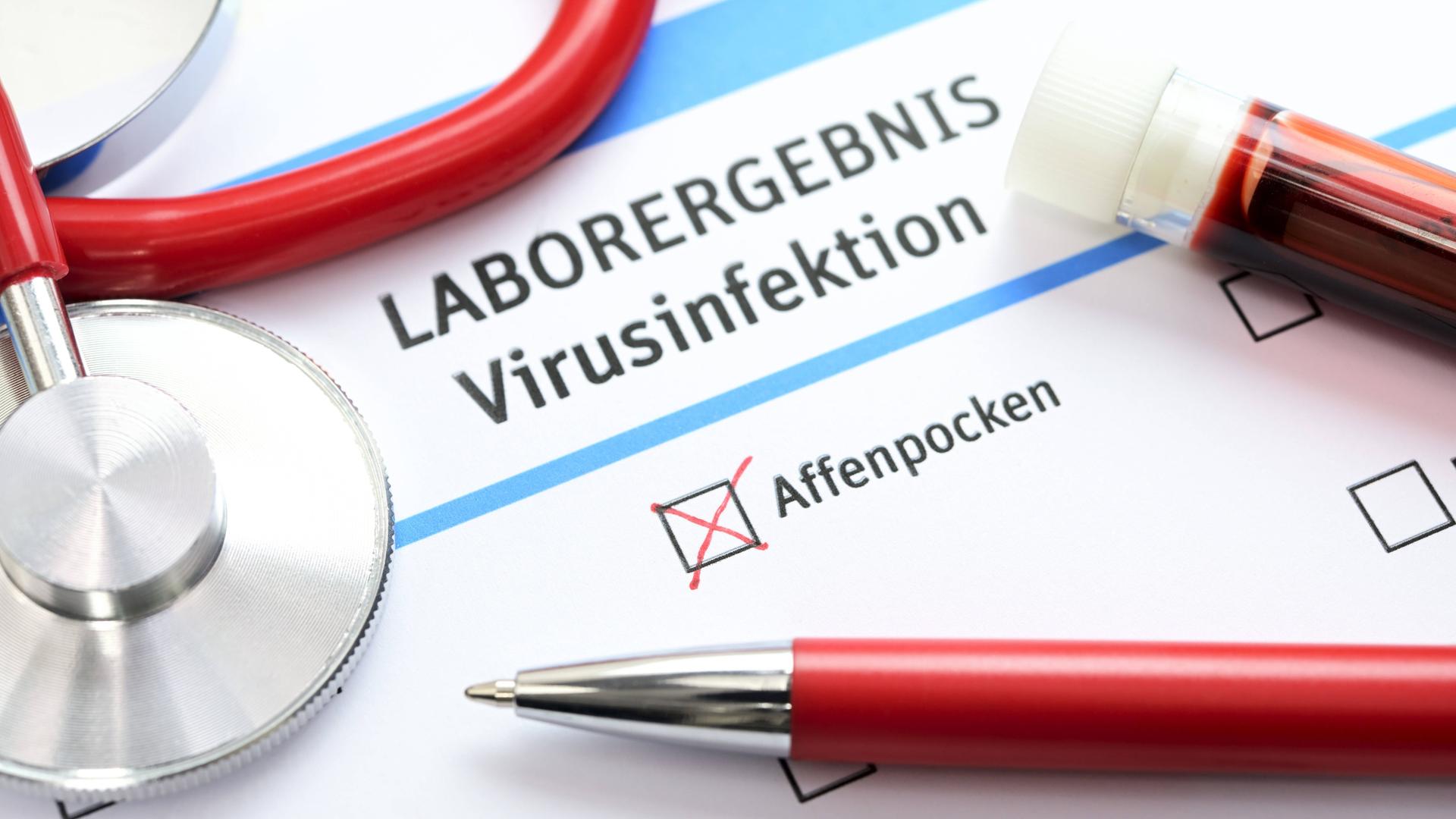Auf dem Papier liegen ein Kugelschreiber, eine Ampulle mit Blut und ein Abhör-Gerät. Es ist ein Affen-Pocken-Test. Auf dem Papier liegen ein Kugelschreiber, eine Ampulle mit Blut und ein Abhör-Gerät. Es ist ein Affen-Pocken-Test.
