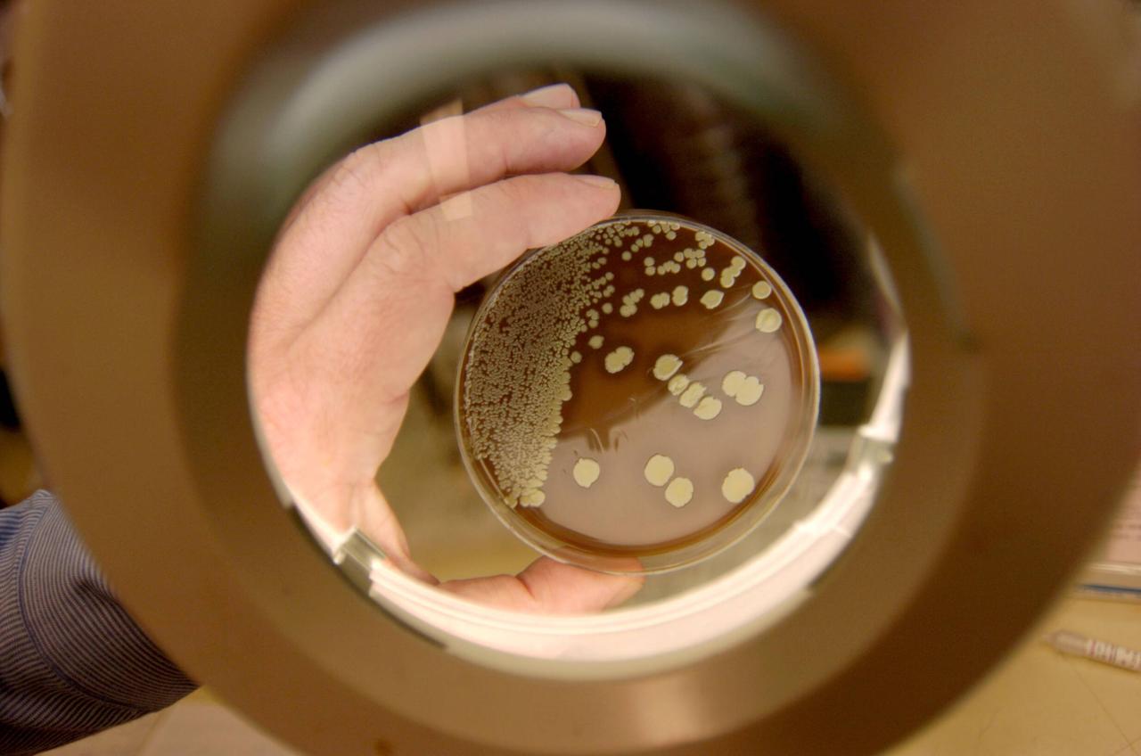 Eine Petrischale mit den multiresistenten Bakterien Staphylococcus Aureus unter einer Lupe. Eine Petrischale mit den multiresistenten Bakterien Staphylococcus Aureus unter einer Lupe.
