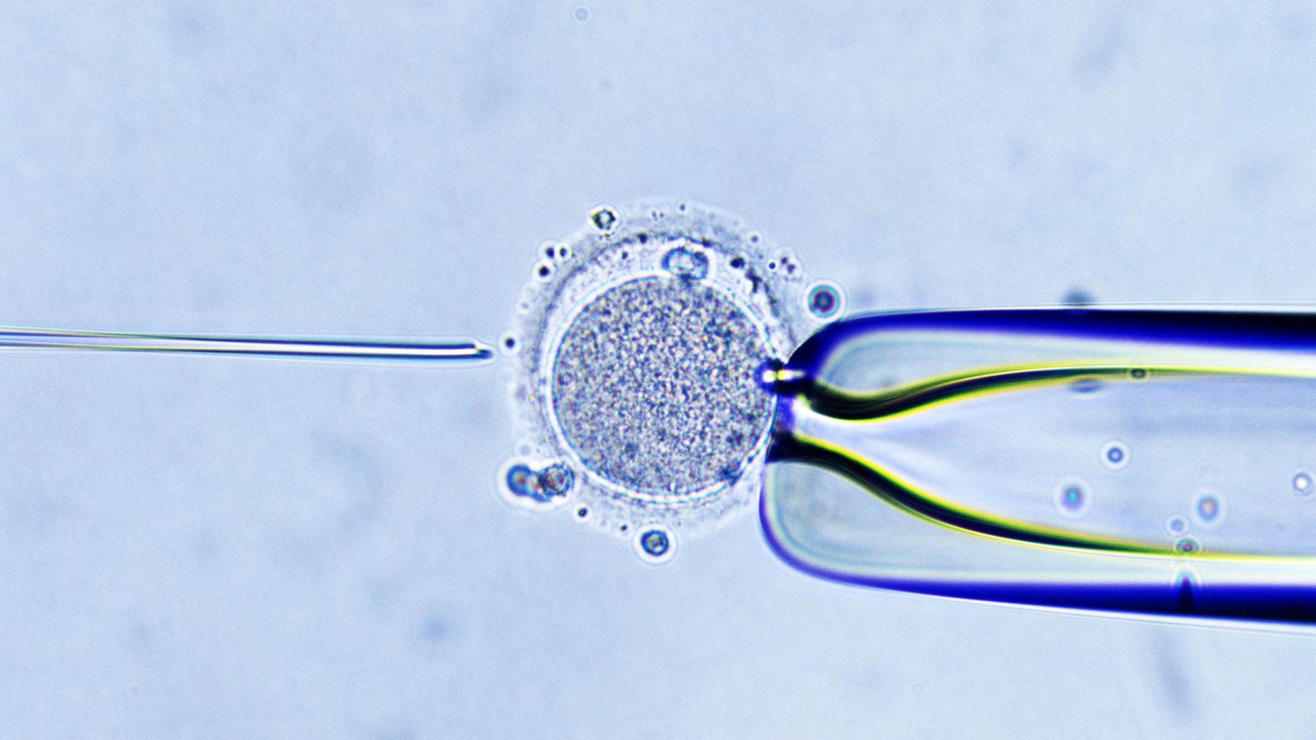 Eine Mikroskopaufnahme der Injektion von einem Spermium in eine Eizelle.