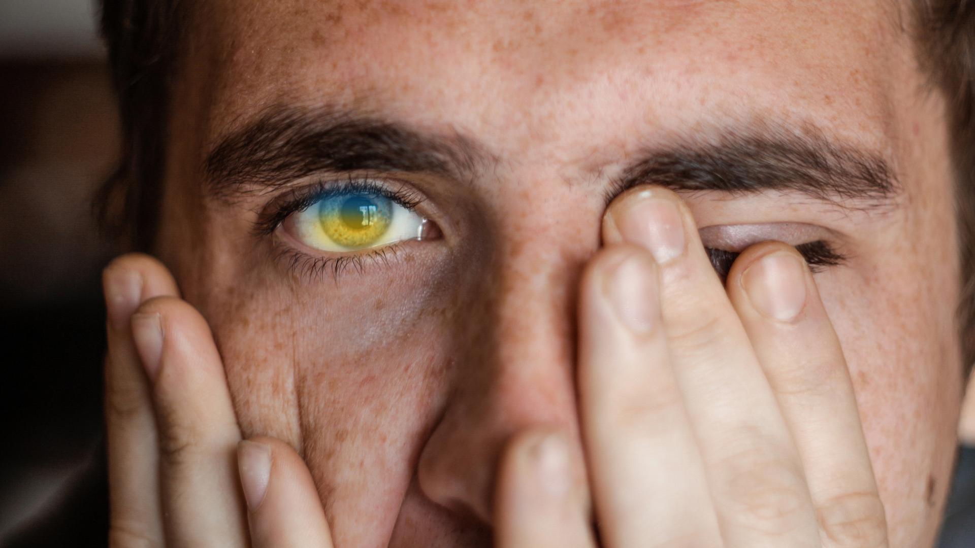 Ein junger Mann vergräbt sein Gesicht in seinen Händen. Im sichtbaren Auge sind die Farben der ukrainischen Flagge erkennbar. Ein junger Mann vergräbt sein Gesicht in seinen Händen. Im sichtbaren Auge sind die Farben der ukrainischen Flagge erkennbar.