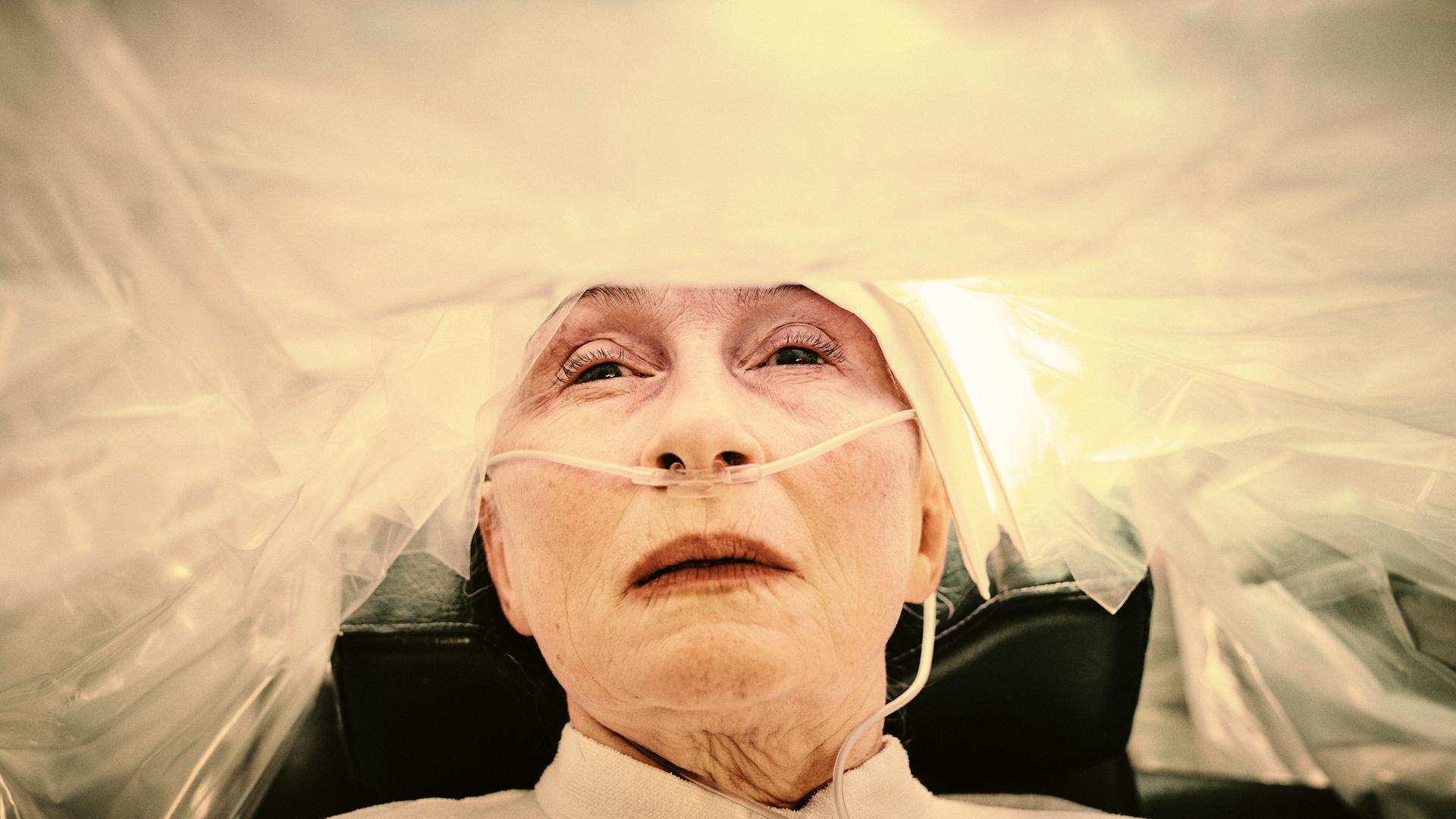 Eine alte Frau mit einer Plastikhülle am Kopf und einem Schlauch in der Nase.