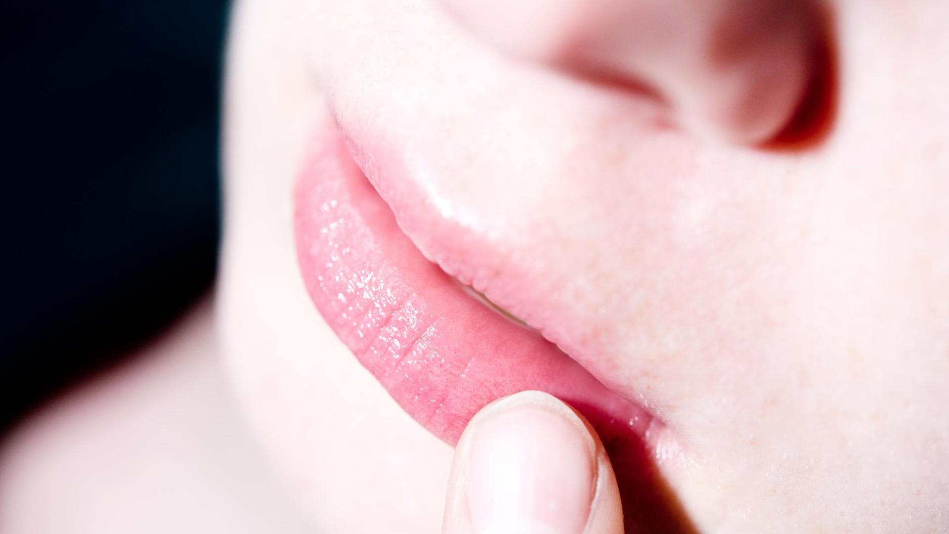 ILLUSTRATION - Eine Frau befühlt mit einem Finger eine juckende und schmerzende Stelle auf ihrer Lippe. Foto: Franziska Gabbert | Verwendung weltweit ILLUSTRATION - Eine Frau befühlt mit einem Finger eine juckende und schmerzende Stelle auf ihrer Lippe. Foto: Franziska Gabbert | Verwendung weltweit