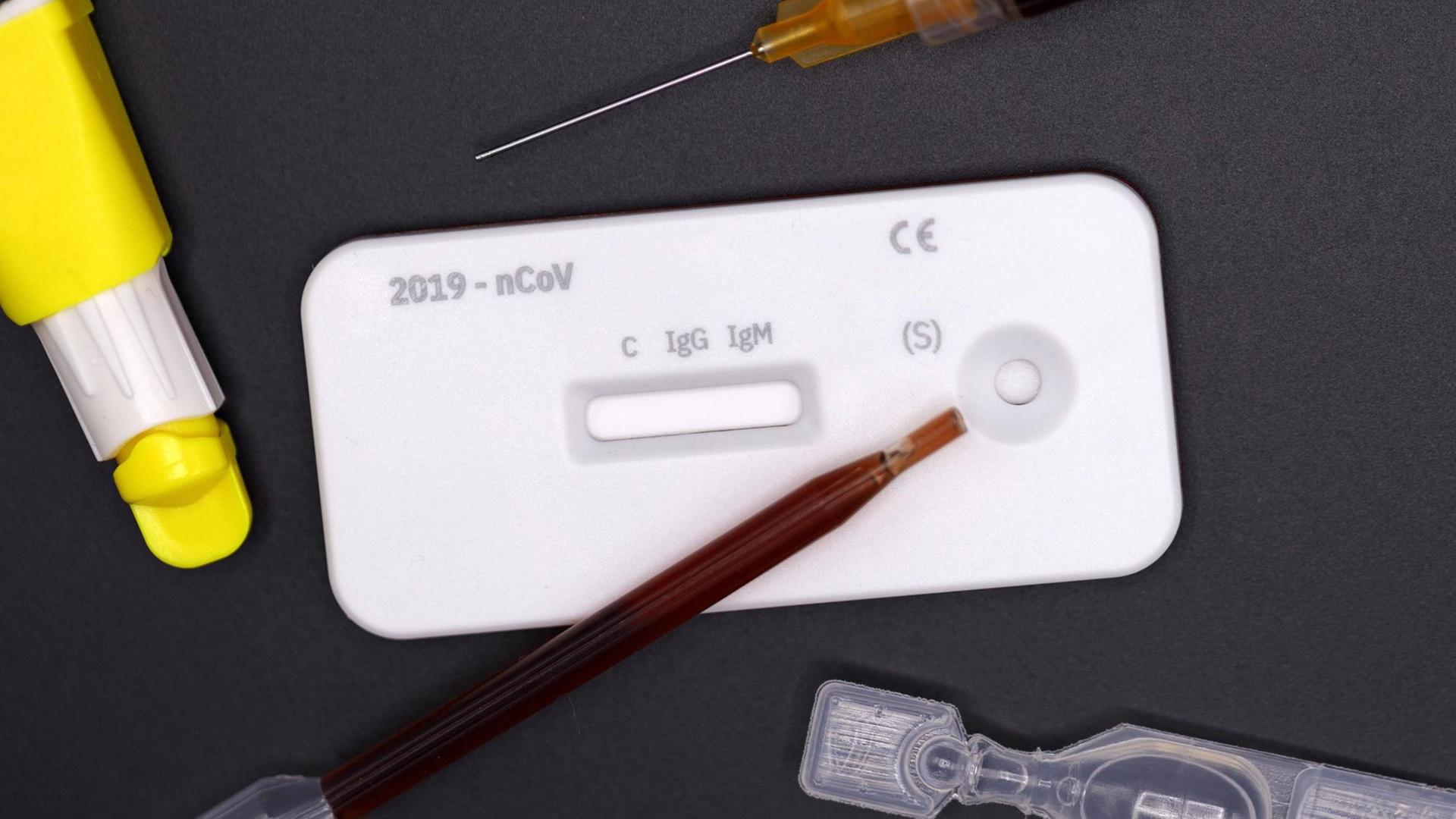 Corona-Test bzw. Cleartest für Corona der Firma servoprax für den qualitativen Nachweis von IgG- und IgM-Antikörpern gegen 2019-nCov in menschlichen Vollblutproben aus der Fingerbeere. *** Corona Test or Cleartest for Corona from servoprax for the qualitative detection of IgG and IgM antibodies against 2019 nCov in human whole blood samples from the fingertip Foto:xC.xHardtx/xFuturexImage Corona-Test bzw. Cleartest für Corona der Firma servoprax für den qualitativen Nachweis von IgG- und IgM-Antikörpern gegen 2019-nCov in menschlichen Vollblutproben aus der Fingerbeere. *** Corona Test or Cleartest for Corona from servoprax for the qualitative detection of IgG and IgM antibodies against 2019 nCov in human whole blood samples from the fingertip Foto:xC.xHardtx/xFuturexImage