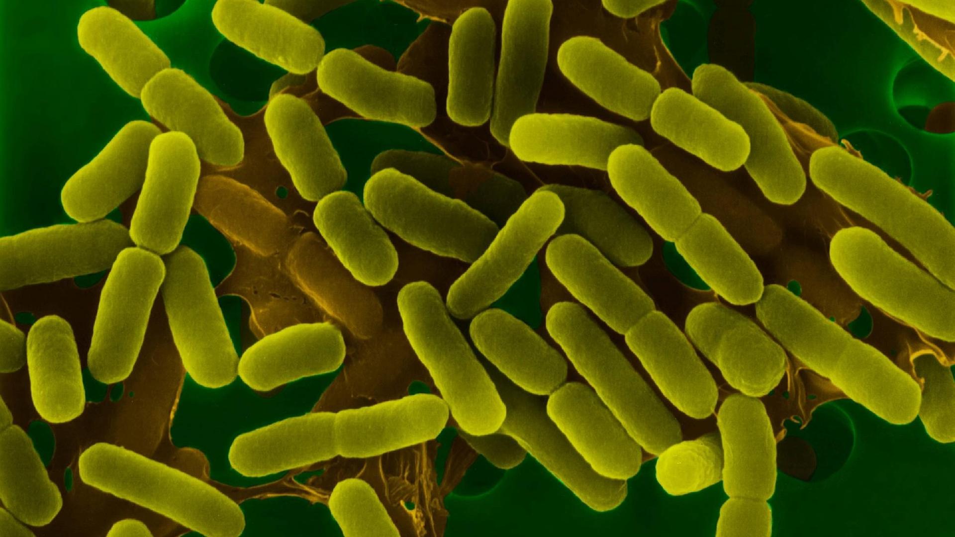 Darmbakterien Escherichia coli unter dem Elektronenmikroskop, grün eingefärbte Aufnahme Darmbakterien Escherichia coli unter dem Elektronenmikroskop, grün eingefärbte Aufnahme