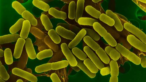 Darmbakterien Escherichia coli unter dem Elektronenmikroskop, grün eingefärbte Aufnahme