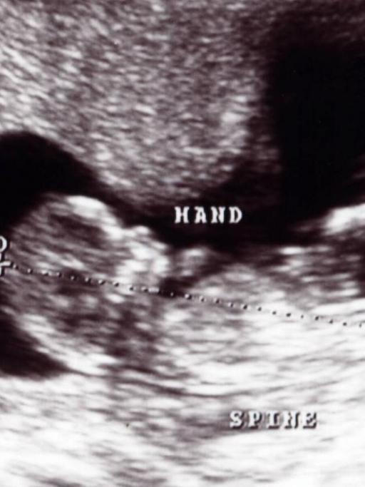 Ultraschallbild eines zwölf Wochen alten Kinds im Mutterleib