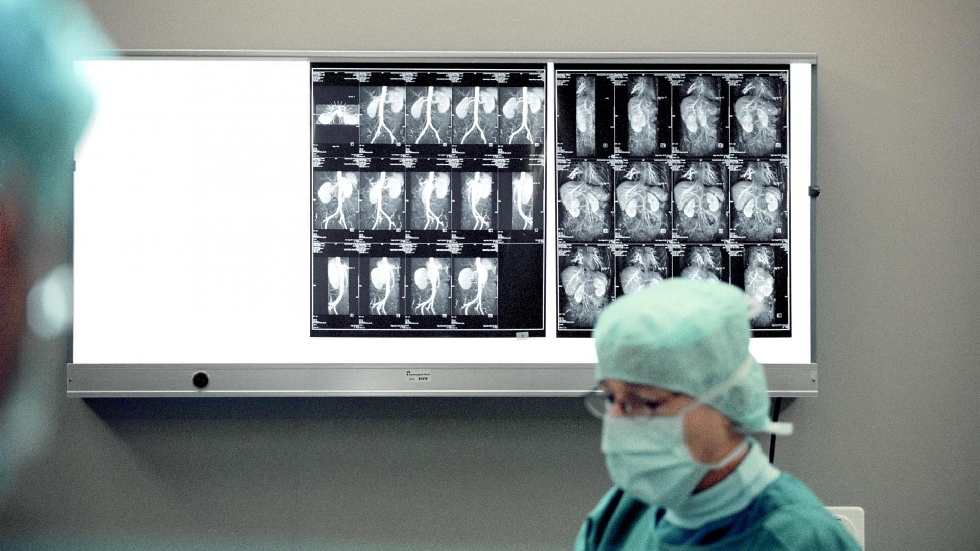 Ein Arzt im Universitätsspital Basel, Schweiz entnimmt einer einer Spenderin eine Niere. Im Hintergrund sind Röntgenbilder des zu entnehmenden Organs zu sehen. Ein Arzt im Universitätsspital Basel, Schweiz entnimmt einer einer Spenderin eine Niere. Im Hintergrund sind Röntgenbilder des zu entnehmenden Organs zu sehen.