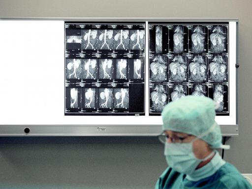 Ein Arzt im Universitätsspital Basel, Schweiz entnimmt einer einer Spenderin eine Niere. Im Hintergrund sind Röntgenbilder des zu entnehmenden Organs zu sehen.