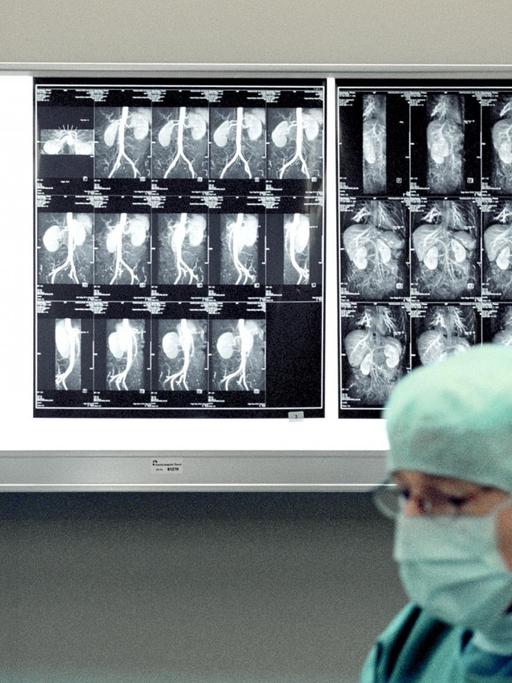 Ein Arzt im Universitätsspital Basel, Schweiz entnimmt einer einer Spenderin eine Niere. Im Hintergrund sind Röntgenbilder des zu entnehmenden Organs zu sehen.