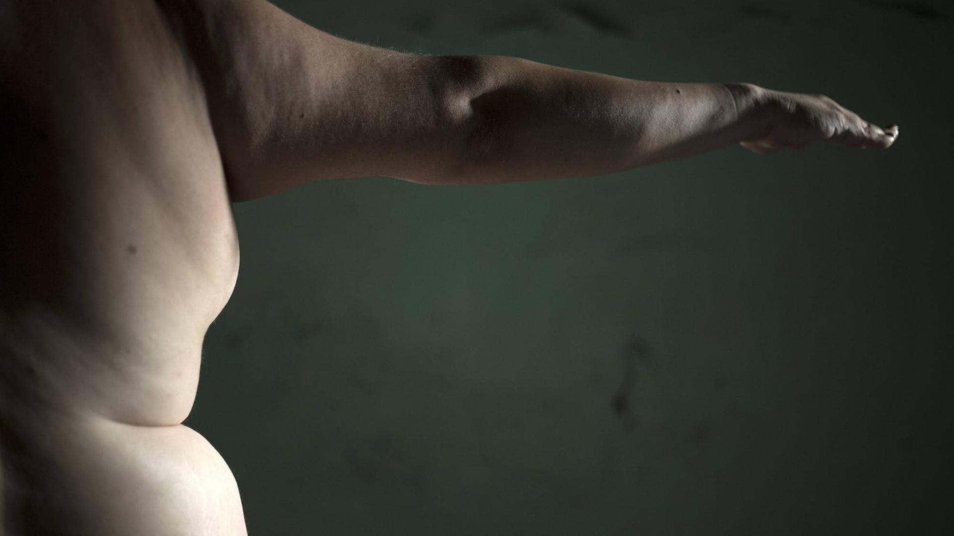 Seitenansicht eines nackten adipösen Menschen. Das Bild zeigt die Hälfte des Rücken im Anschnitt, von der Schulter bis zum Becken mit einem ausgestreckten Arm. Seitenansicht eines nackten adipösen Menschen. Das Bild zeigt die Hälfte des Rücken im Anschnitt, von der Schulter bis zum Becken mit einem ausgestreckten Arm.
