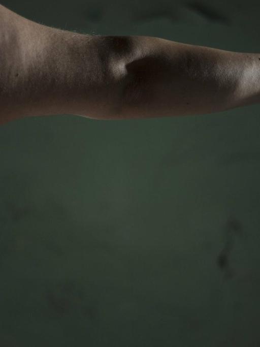 Seitenansicht eines nackten adipösen Menschen. Das Bild zeigt die Hälfte des Rücken im Anschnitt, von der Schulter bis zum Becken mit einem ausgestreckten Arm.