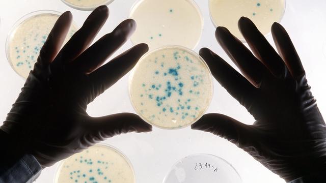 Zwei Hände fassen eine Petrischale mit Bakterienkulturen zur Genvermehrung.
