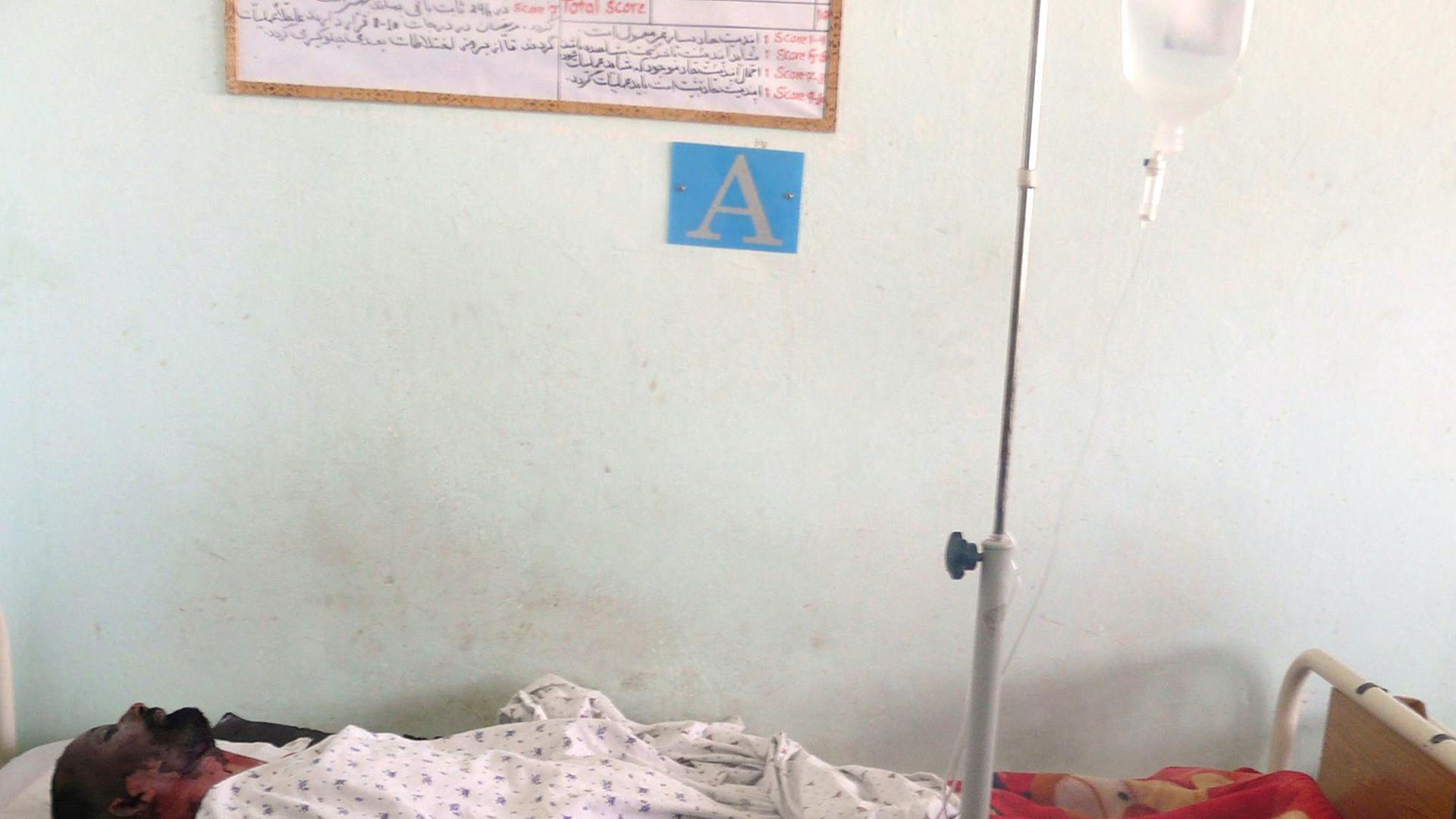 Ein Verletzter des NATO-Luftangriffs im afghanischen Kundus liegt in einem Krankenbett, wo er medizinisch versorgt wird. Ein Verletzter des NATO-Luftangriffs im afghanischen Kundus liegt in einem Krankenbett, wo er medizinisch versorgt wird.