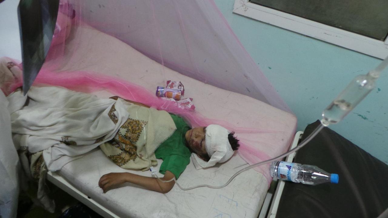 Ein jemenitischer Junge wird medizinisch versorgt, nachdem er einen Luftangriff auf einen Schulbus überlebt hat.