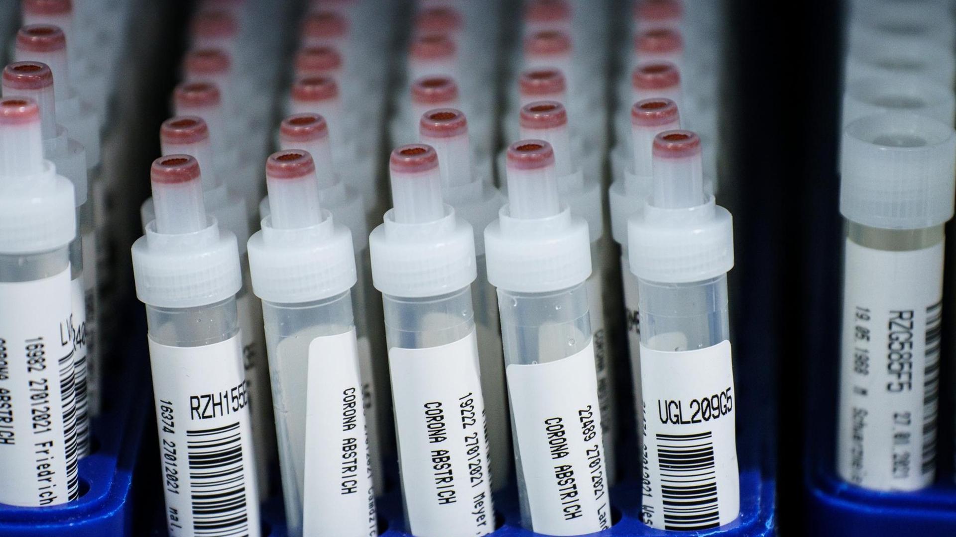 Kunststoffröhrchen mit Corona-Abstrichen nach PCR-Test im Großlabor von Bioscientia Kunststoffröhrchen mit Corona-Abstrichen nach PCR-Test im Großlabor von Bioscientia