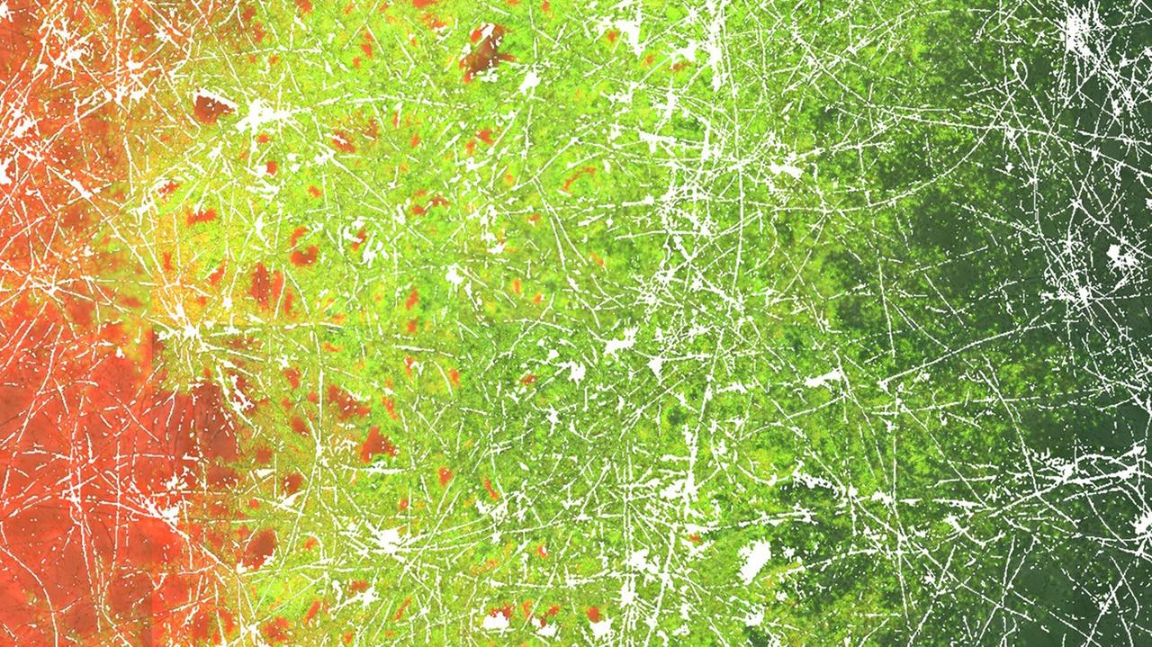 Mikroskopische Aufnahme der Verbreitung von Bakterien (Grün) entlang eines Hyphengeflechts (Weiß). Diese Bakterien entstehen durch Gentransfer – über den direkten Kontakt von Bakterien , die in unterschiedlichen Richtungen auf den Hyphen unterwegs sind. Mikroskopische Aufnahme der Verbreitung von Bakterien (Grün) entlang eines Hyphengeflechts (Weiß). Diese Bakterien entstehen durch Gentransfer – über den direkten Kontakt von Bakterien , die in unterschiedlichen Richtungen auf den Hyphen unterwegs sind.