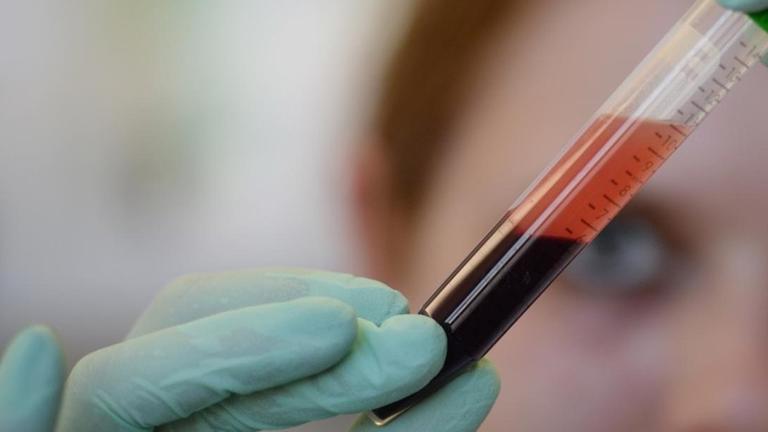 Eine Medizinisch-Technische Aisstentin überprüft die Blutprobe einer schwangeren Frau auf Trisomien 21, 18 und 13 beim ungeborenen Kind Eine Medizinisch-Technische Aisstentin überprüft die Blutprobe einer schwangeren Frau auf Trisomien 21, 18 und 13 beim ungeborenen Kind