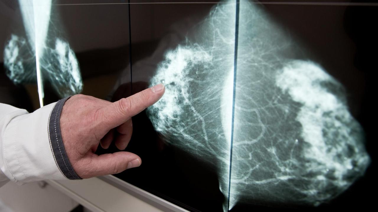 Eine Röntgenuntersuchung