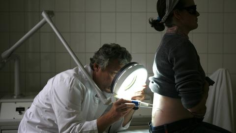 Ein Dermatologe entfernt mit einem Laser die Tätowierung einer Patientin.
