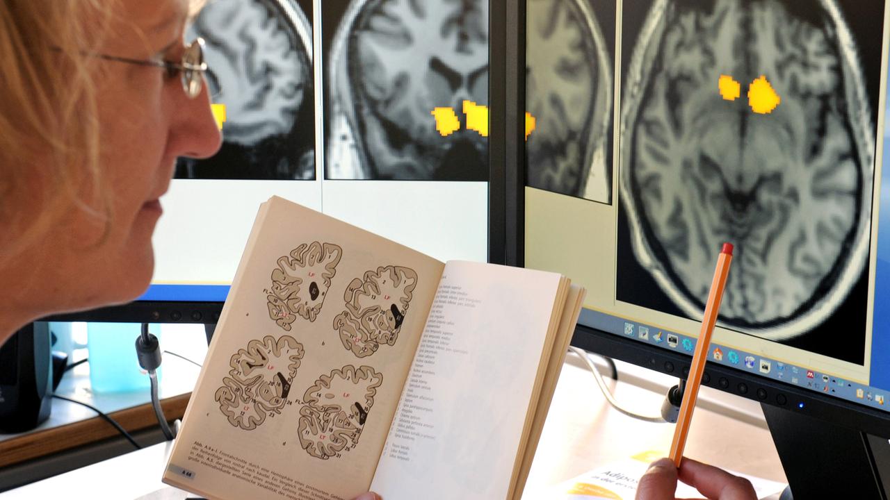 Die wissenschaftliche Mitarbeiterin des Projektes Neurobiologie des Übergewichtes am Max-Planck-Institut für Kognitions- und Neurowissenschaften, Dr. Annette Horstmann, vergleicht Ergebnisse von im MRT erstellten Hirnstrukturen und Funktionen, die zum Beispiel auf Essensreize dargestellt werden, aufgenommen am 02.11.2011. Die wissenschaftliche Mitarbeiterin des Projektes Neurobiologie des Übergewichtes am Max-Planck-Institut für Kognitions- und Neurowissenschaften, Dr. Annette Horstmann, vergleicht Ergebnisse von im MRT erstellten Hirnstrukturen und Funktionen, die zum Beispiel auf Essensreize dargestellt werden, aufgenommen am 02.11.2011.