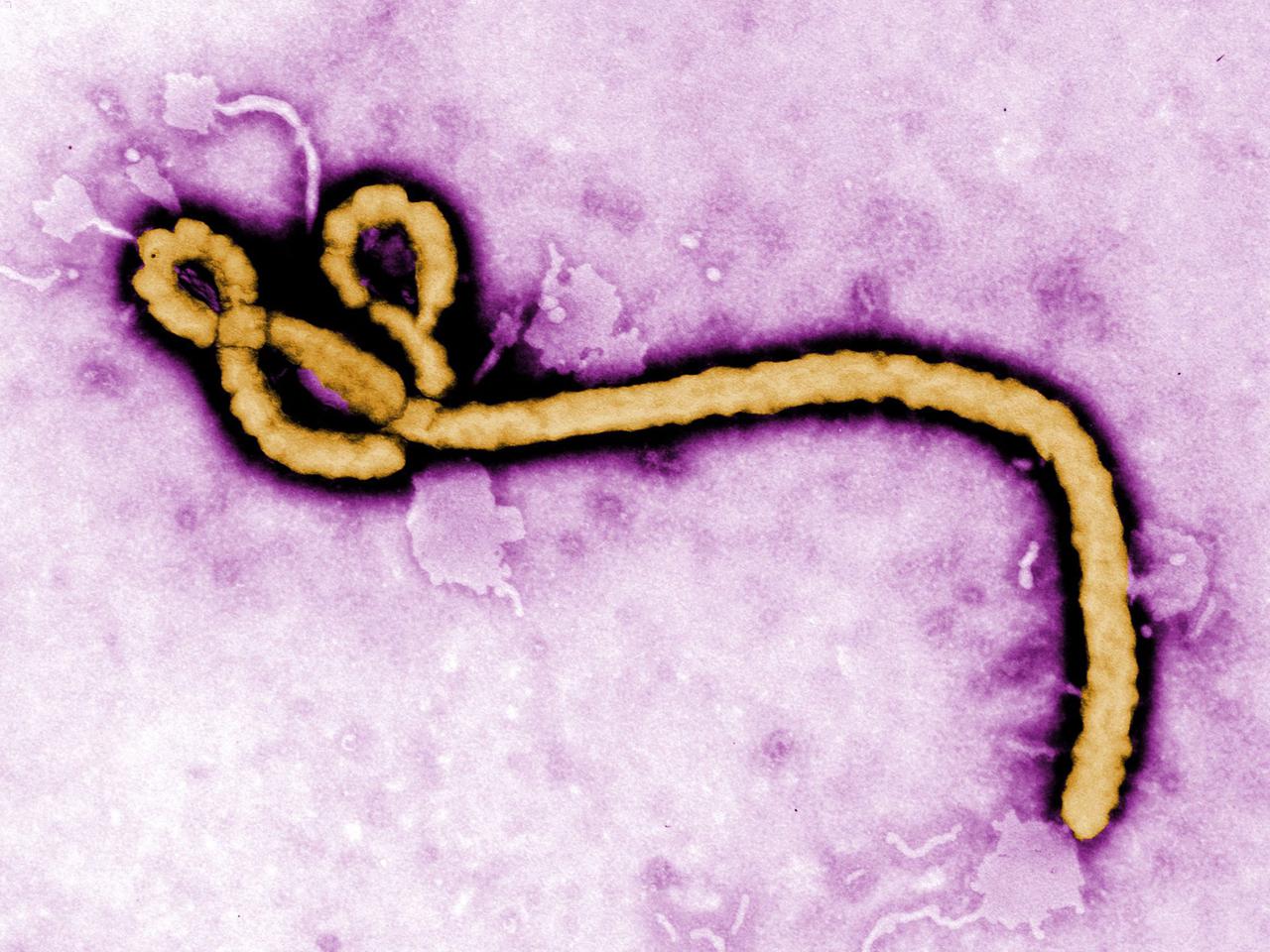 Mikroskop-Aufnahme des Ebola-Virus Mikroskop-Aufnahme des Ebola-Virus