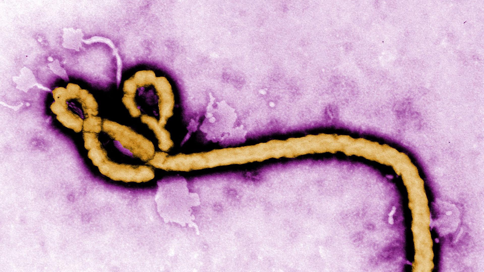 Mikroskop-Aufnahme des Ebola-Virus Mikroskop-Aufnahme des Ebola-Virus