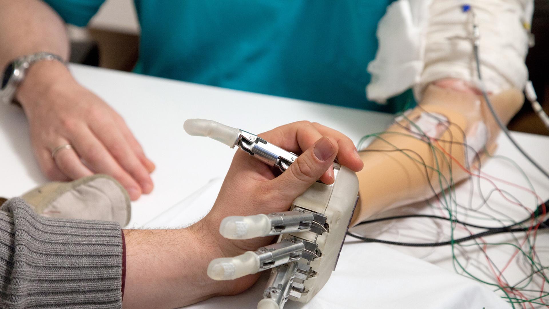 Handprothese und normale Hand fassen ineinander. Handprothese und normale Hand fassen ineinander.