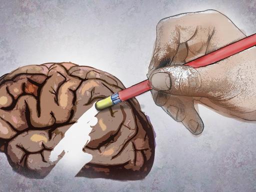 Graphische Darstellung von Demenz. Eine Hand hält einen Stift mit einem Radiergummi. Damit radiert sie einen Teil des Gehirns weg.
