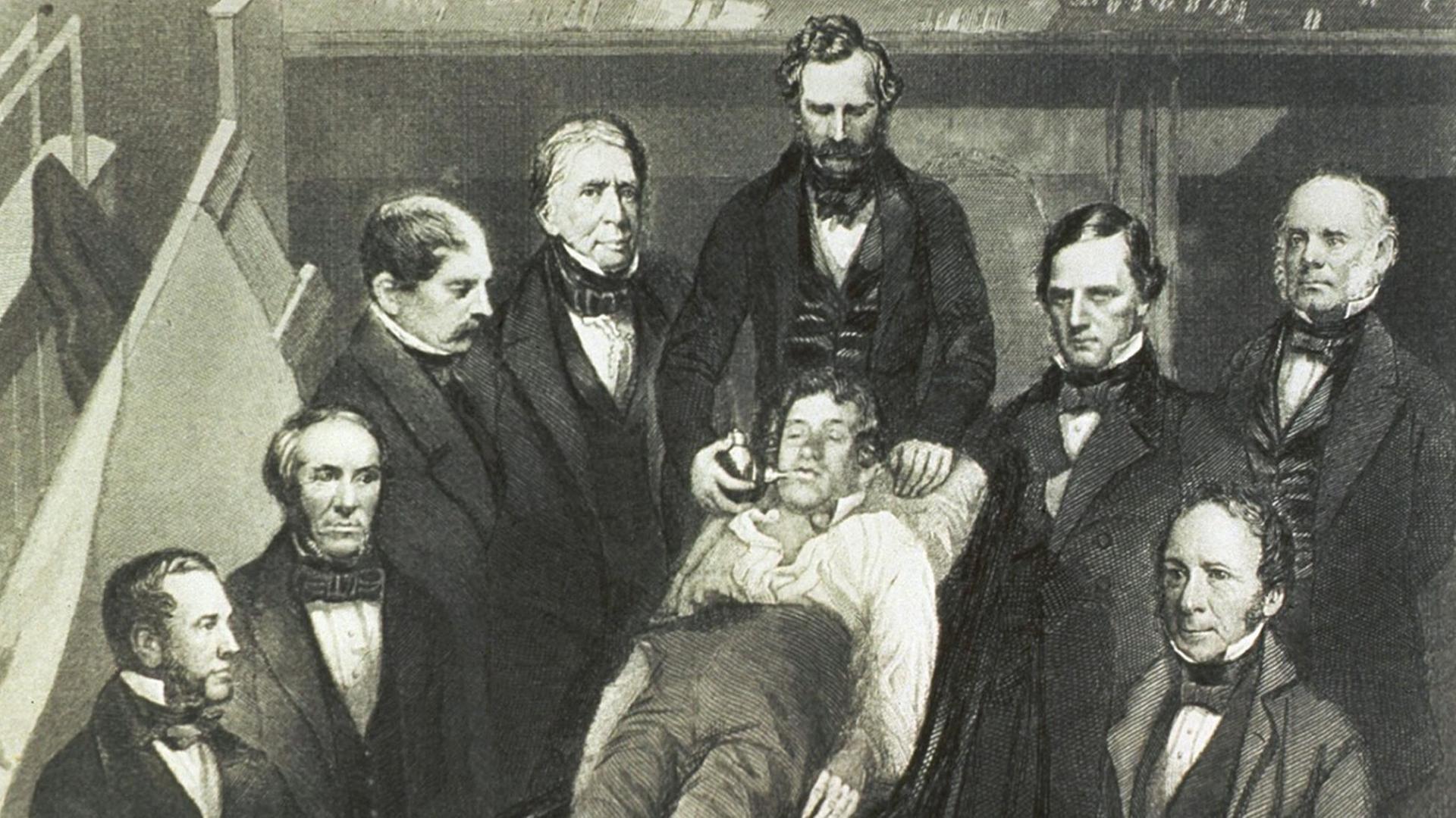Der Arzt William Morton verabreicht 1846 Äther an einen Patienten vor dessen Turmoroperation. und ist von zahlreichen Kollegen umgeben. Der Arzt William Morton verabreicht 1846 Äther an einen Patienten vor dessen Turmoroperation. und ist von zahlreichen Kollegen umgeben.