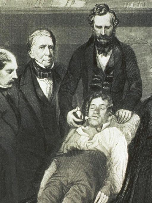 Der Arzt William Morton verabreicht 1846 Äther an einen Patienten vor dessen Turmoroperation. und ist von zahlreichen Kollegen umgeben.