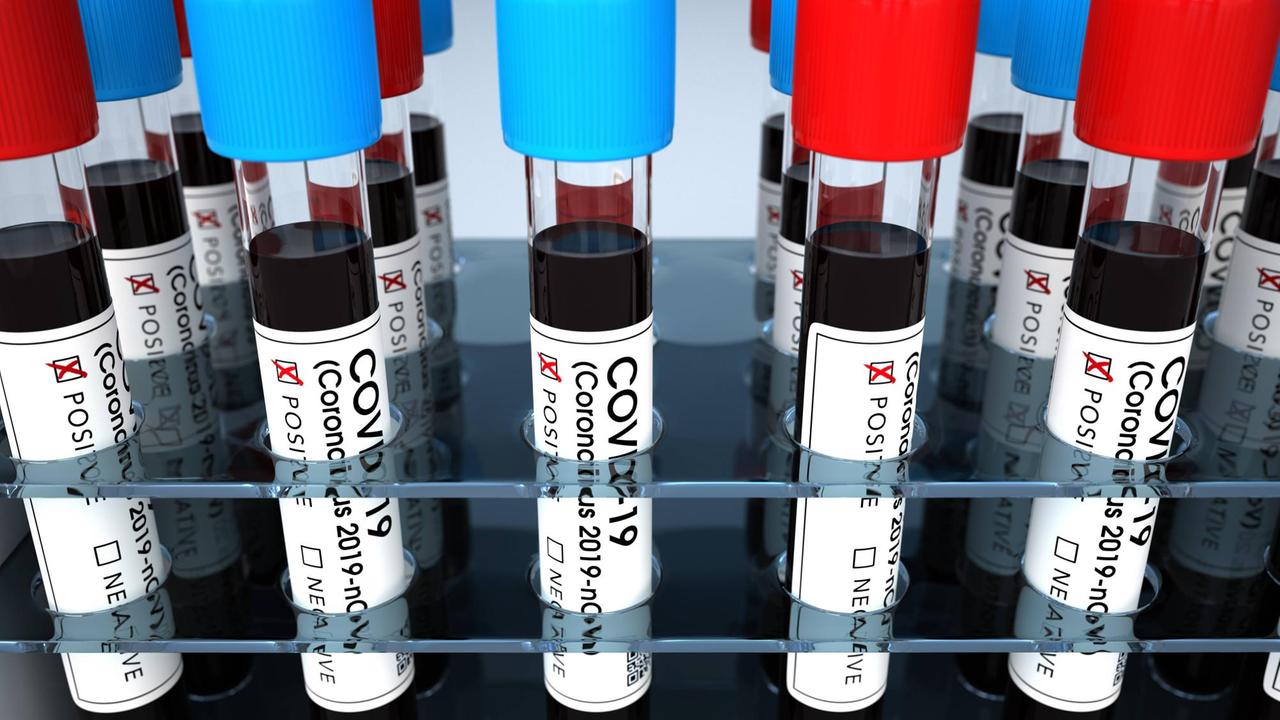 Positive Corona Test Tubes Positive corona test tubes. 3d illustration. Positive Corona Test Tubes Positive corona test tubes. 3d illustration.