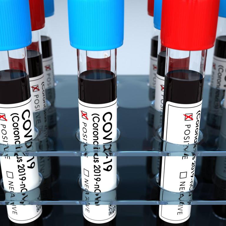 Positive Corona Test Tubes Positive corona test tubes. 3d illustration. 