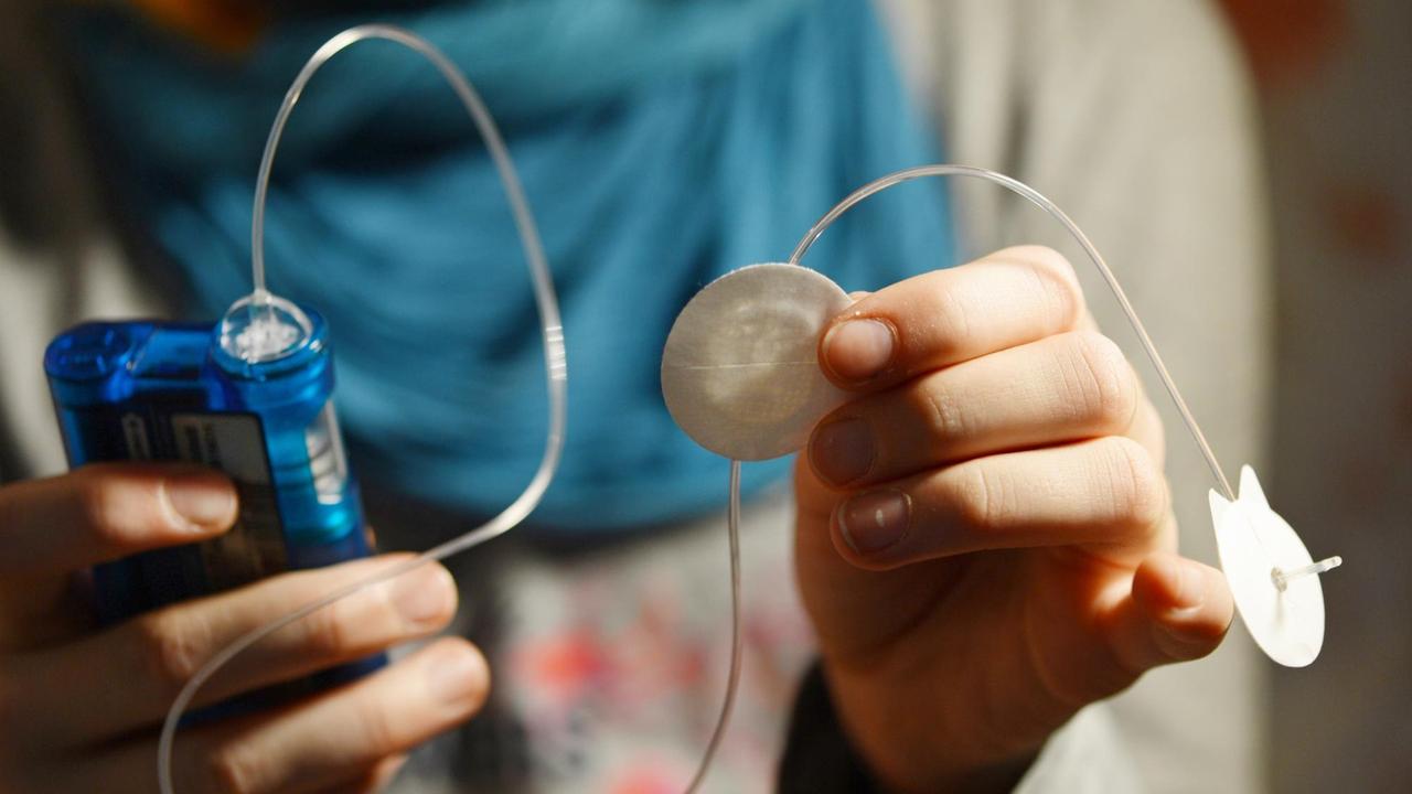 Ein an Diabetes Typ 1 erkranktes Mädchen pumpt Insulin durch den Katheter ihrer Insulinpumpe, um Luftbläschen aus dem Katheterschlauch zu entfernen. Ein an Diabetes Typ 1 erkranktes Mädchen pumpt Insulin durch den Katheter ihrer Insulinpumpe, um Luftbläschen aus dem Katheterschlauch zu entfernen.