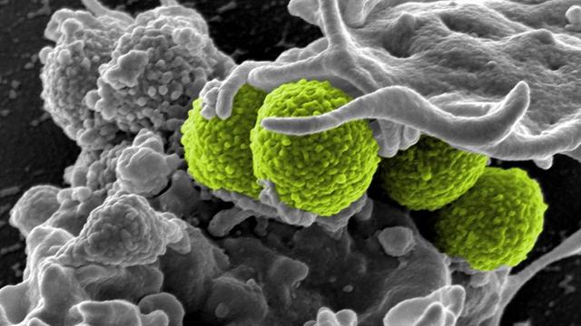 Staphylococcus aureus-Bakterien (grün) werden von einer großen menschlichen Blutzelle (grau) umschlossen.