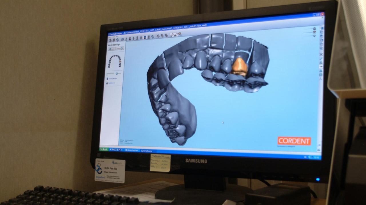 3-D-Bild eines Zahnkiefers zur Herstellung von Zahnersatz. 3-D-Bild eines Zahnkiefers zur Herstellung von Zahnersatz.