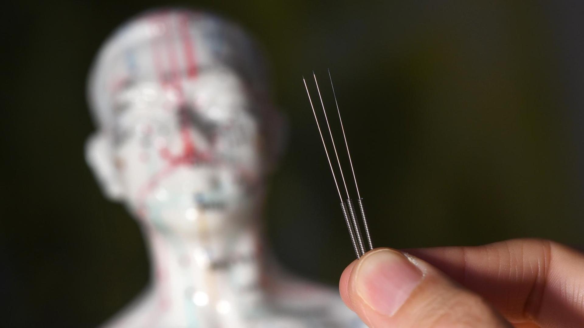 Ein Stich mit der Nadel an der richtigen Körperstelle lässt die Energie fließen und lindert so Schmerzen oder heilt Krankheiten. Ein Stich mit der Nadel an der richtigen Körperstelle lässt die Energie fließen und lindert so Schmerzen oder heilt Krankheiten.